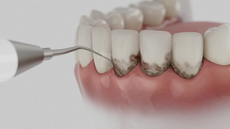 Reliable Wisdom Tooth Removal contractor in Guilford County County, NC by Dentist Open Now